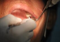 Finding Dog Dental Care Near Me