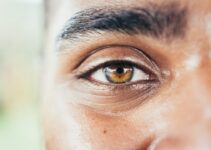 “Understanding Pet Eye Health”