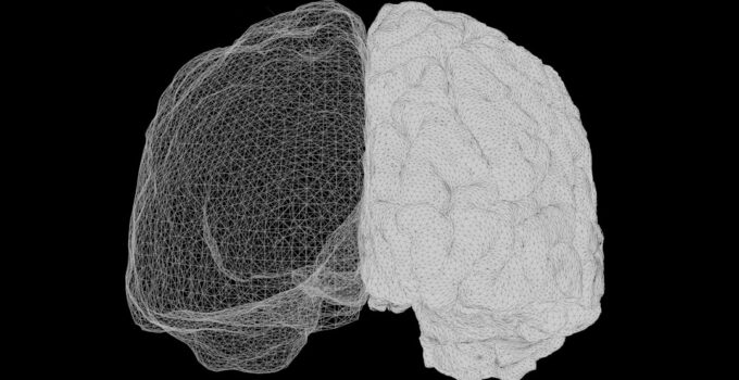 Photo Brain diagram