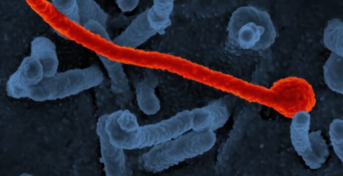Photo Parasite Prevention