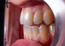 Pet Dental Health: Home Care vs Professional Cleaning