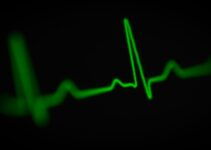 How to Monitor Pet Heart Rates with Wearables