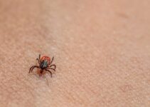 How to Remove Ticks from Your Dog Properly