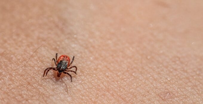 Photo Remove Ticks