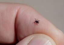 How to Remove Ticks From Your Pet