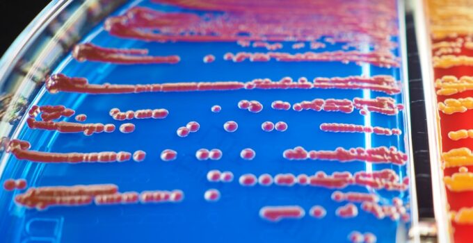 How to Discover the Hidden World of Microorganisms Living on Your Body